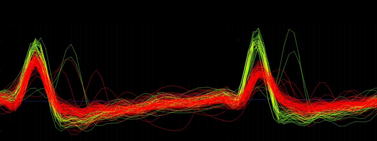 action_potentials