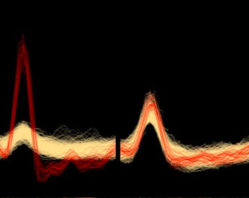 Action potentials from two cells recorded in vivo.
