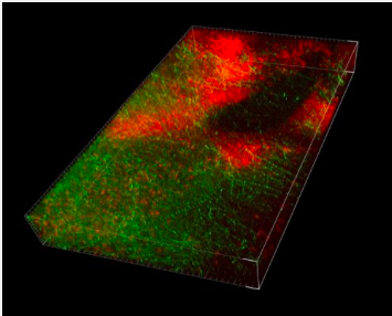 CLARITY-processed brain section showing cortical axons (green) in the amygdala.