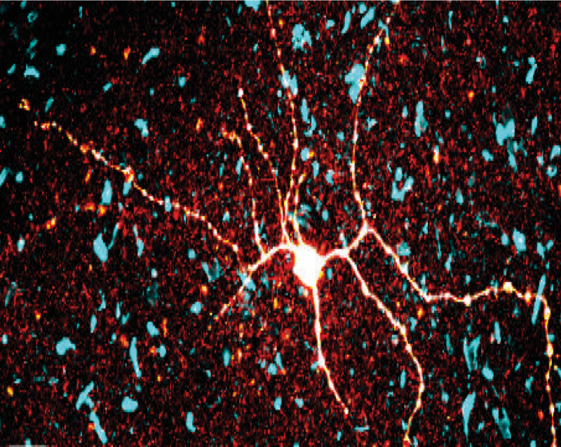 Hypothalamic cell filled with biocytin